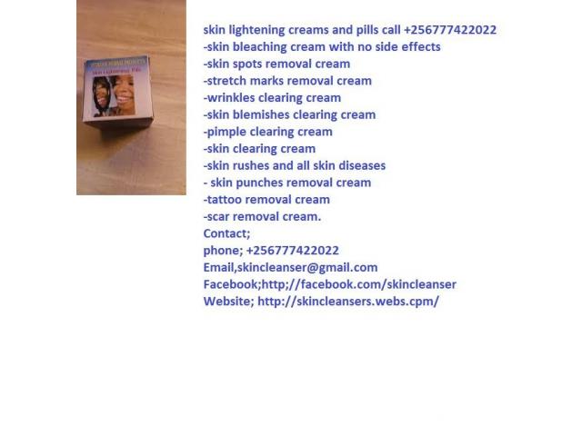 skin lightening creams and pills 256777422022