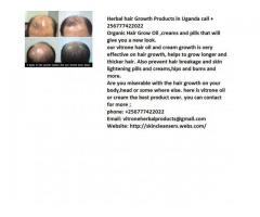 Herbal hair Growth Products in call +256777422022